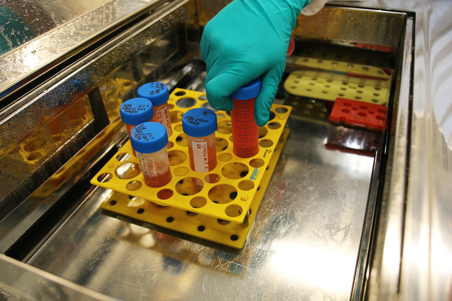 Neuroblastoma research